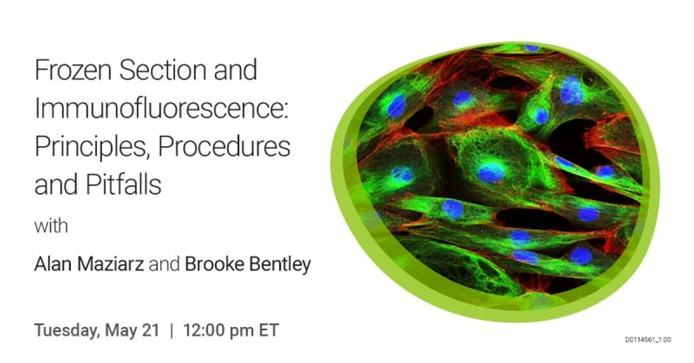Agilent: Frozen Section and Immunofluorescence: Principles, Procedures and Pitfalls