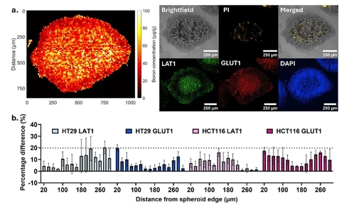 Quantitative LA-ICP-MS Imaging of Elemental Distributions with Protein Correlation in 3D Tumor Models