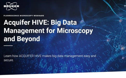 Acquifer HIVE: Big Data Management for Microscopy and Beyond