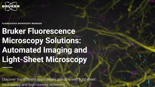 Bruker Fluorescence Microscopy Solutions: Automated Imaging and Light-Sheet Microscopy