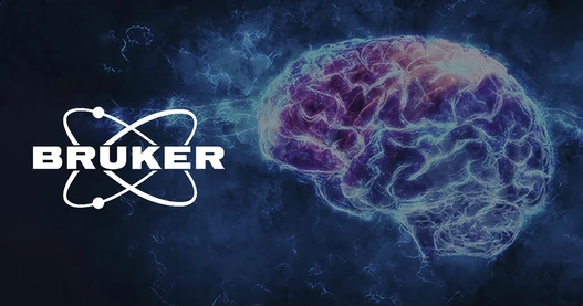 From Neural Recording to Functional Insight: Accelerating Discovery with the Inscopix Integrated Workflow 