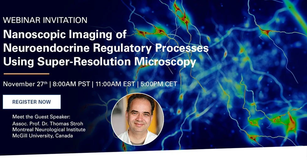 Bruker: Nanoscopic Imaging of Neuroendocrine Regulatory Processes Using Super-Resolution Microscopy
