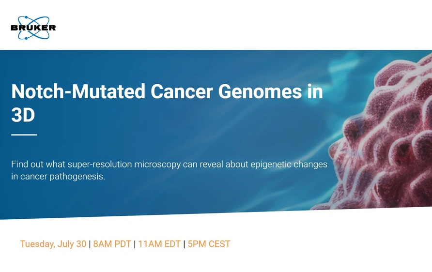 Bruker: Notch-Mutated Cancer Genomes in 3D