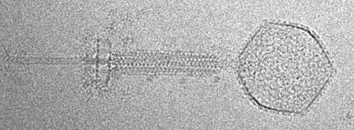 CEITEC/Plevka Lab: How to Kill Staphylococcus Aureus: A New Insight into Viruses That Can Defeat Bacteria: Phage before attachment to the bacterial cell.