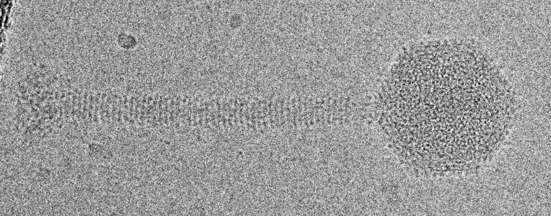 CEITEC/Plevka Lab: How to Kill Staphylococcus Aureus: A New Insight into Viruses That Can Defeat Bacteria: Phage attached to the bacterial cell.