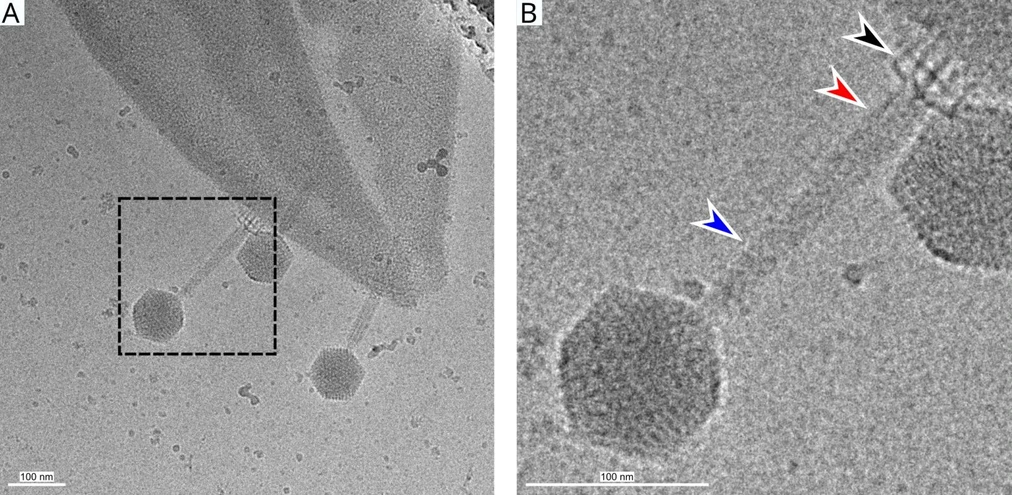 <p><strong>CEITEC/Plevka Lab: </strong>How to Kill Staphylococcus Aureus: A New Insight into Viruses That Can Defeat Bacteria </p>