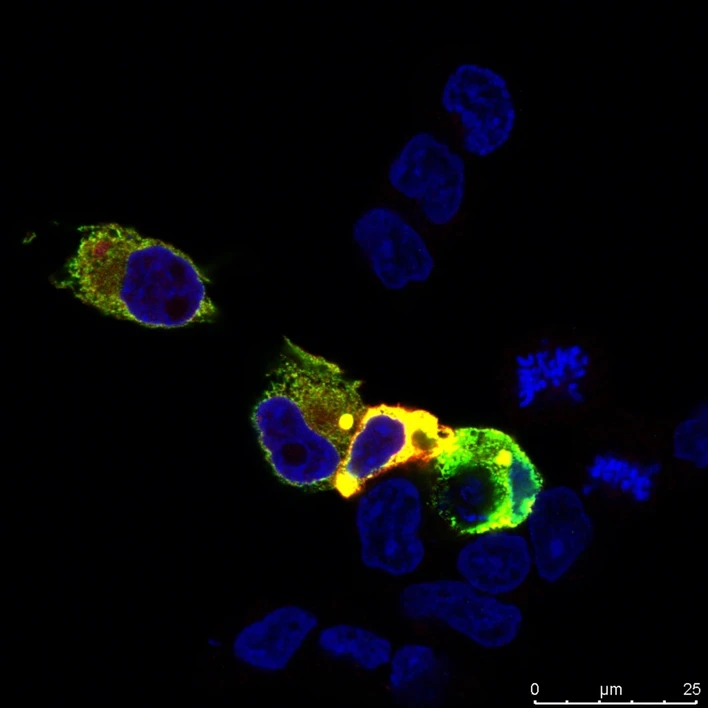 CEITEC/Tripsianes Lab: Scientists Uncover a Tipping Point in Cells. This Is How Cancer May Begin: DVL in a cell (green), enzym modifiyng DVL (red), cell nucleus (blue)
