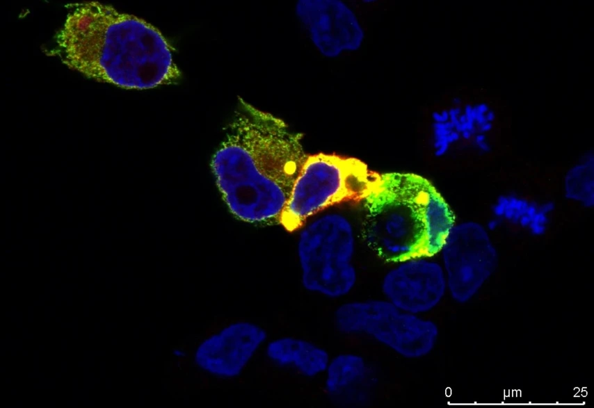 <p><strong>CEITEC/Tripsianes Lab: </strong>Scientists Uncover a Tipping Point in Cells. This Is How Cancer May Begin&nbsp;</p>