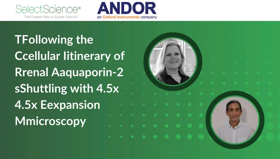 SelectScience: The Cellular Itinerary of Renal Aquaporin-2 Shuttling with 4.5x Expansion Microscopy