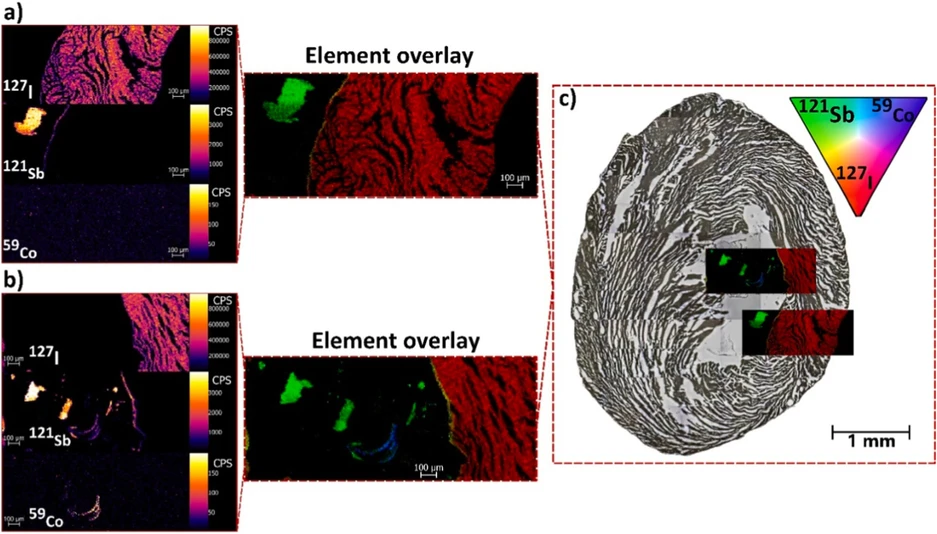 Talanta 308, 2026, 129794: Fig. 3. Identification of chemically distinct Sb- and Co-rich MPs lodged within the tissue cavity using LA-ICP-MS.