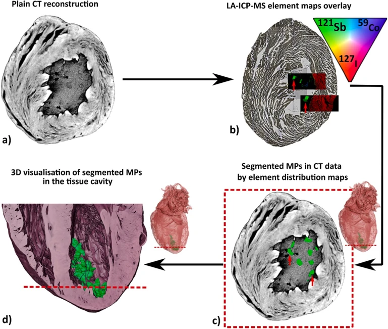 Talanta 308, 2026, 129794: Fig. 4. Dual-modality workflow of using CT and LA-ICP-MS for MP imaging.