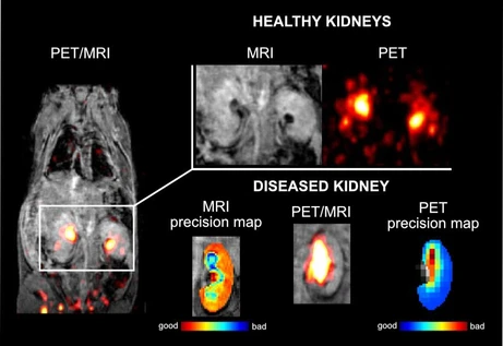 New PET/MRI probe developed by IOCB Prague promises early discovery of covert diseases